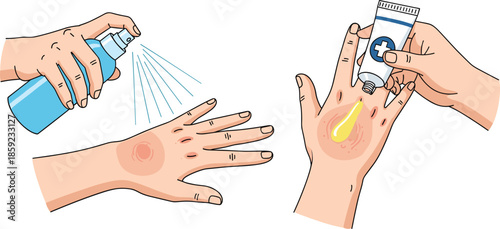 Hands treating skin rash with antiseptic spray and healing ointment illustrating first aid, dermatology care, allergy, and wound treatment