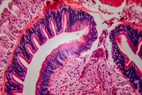 Histological section of the intestinal mucosa, showing villi, epithelial cells, and nuclei in bright staining.