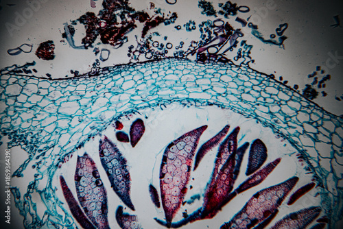 Cuadro en lienzo Microscopic view of human skin tissue stained in blue and magenta, highlighting multiple hair follicles embedded in the dermis and surrounding connective tissue