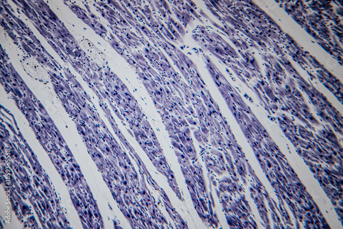 Microscopic view of heart muscle tissue stained in blue, showing elongated, striated muscle fibers with centrally located nuclei arranged.