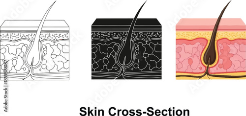 Set of skin cross-section illustrations showing hair follicle anatomy in line art silhouette and realistic styles for medical and cosmetic use