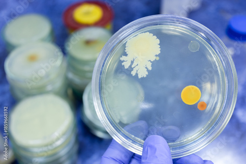 Petri dish with bacterial colonies in scientist's hand, against background of laboratory workbench with stacks of petri dishes.