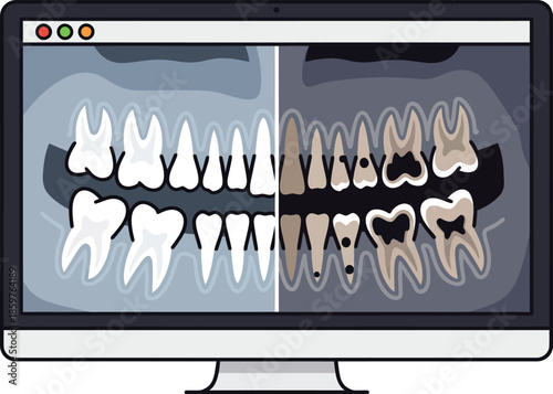 Detailed X-ray image of human teeth displayed on a computer screen