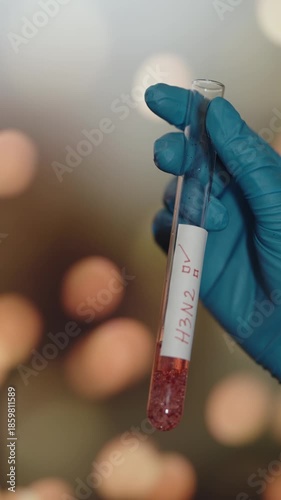 Gloved Hand Holding H3N2 Blood Sample for Virus Testing