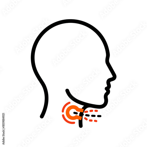 Human profile showing throat swelling and airway blockage for anaphylaxis and severe allergic reaction concept