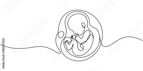 Baby embryo in womb one line drawing. Cute unborn fetus baby on mother womb isolated on white background, Baby embryo in womb in one continuous line drawing. Healthy pregnancy and premature symbol