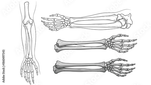 Detailed anatomical illustrations of the human arm and hand bones, showing the radius, ulna, carpals, and metacarpals.