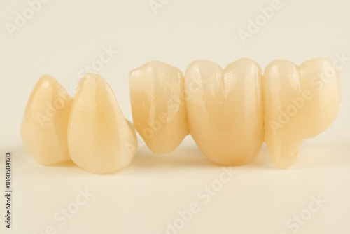 ceramic dental bridge isolated on sold surface