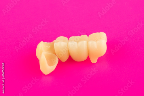 ceramic dental bridge isolated on sold surface