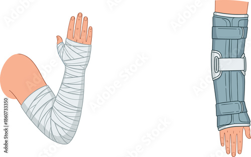 Injured arm with cast and splint injury medical