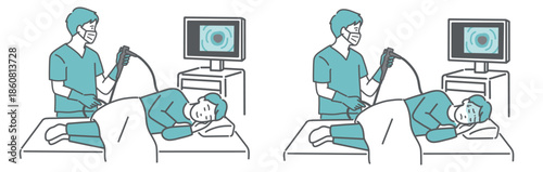大腸カメラ検査の比較イラスト（鎮静剤あり・なし／無痛・苦痛）