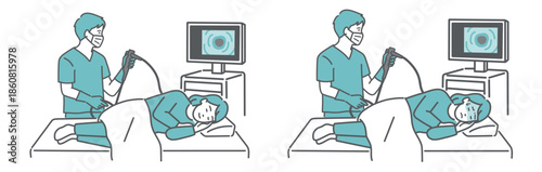 大腸カメラ検査の比較イラスト（女性・鎮静剤あり・なし／無痛・苦痛）