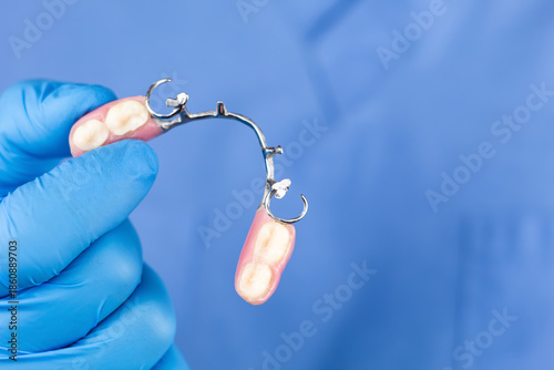 Fotografija Dentist's hand showing a removable cobalt-chromium partial denture