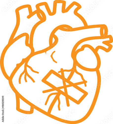 Orange outline of a human heart with tape across the ventricle, graphic illustration