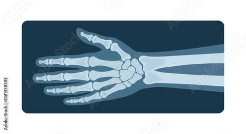 A comprehensive X-ray style illustration depicting the intricate bone structure of the human hand and wrist, ideal for medical education and