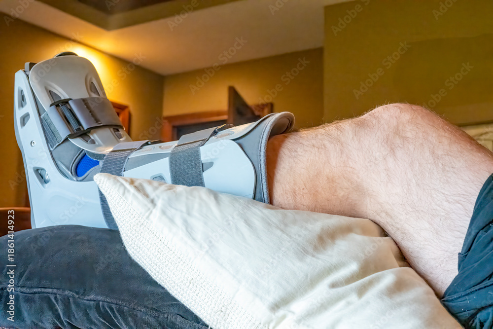 Obraz premium Foot in a medical boot resting on a pillow in a living room during the daytime