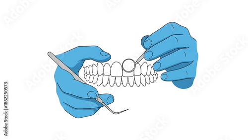 A medical illustration depicting a dentist's hands in blue gloves using dental instruments, examining a set of teeth. The illustration is minimalist