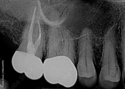 Grayscale dental imaging of teeth and dental work