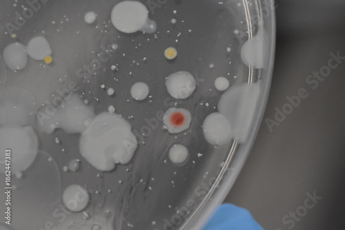 Принти на полотні Bacterial colonies growing on an agar plate in a Petri dish in a microbiology laboratory