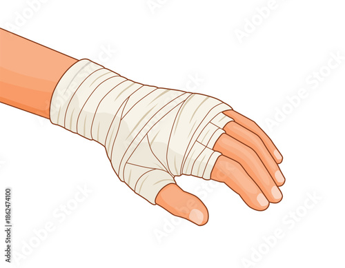 Injured hand with wrist and arm wrapped in bandage 