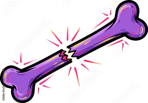 Cartoon illustration of a fractured purple bone with radiating pain