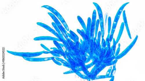 Cuadro en lienzo Fusarium citri sporodochial conidiophores bearing macroconidia under microscope