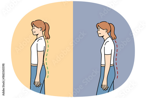 Scoliosis or osteochondrosis in woman, due to problems with posture and sore spine, which has recovered after doing fitness. Problem scoliosis in female office employee because of sedentary lifestyle