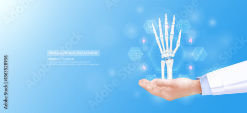 Wrist joint replacement model in doctor hand. Hand joint bone surrounded by medical icons. Technologies in science health care. Realistic 3D Vector.
