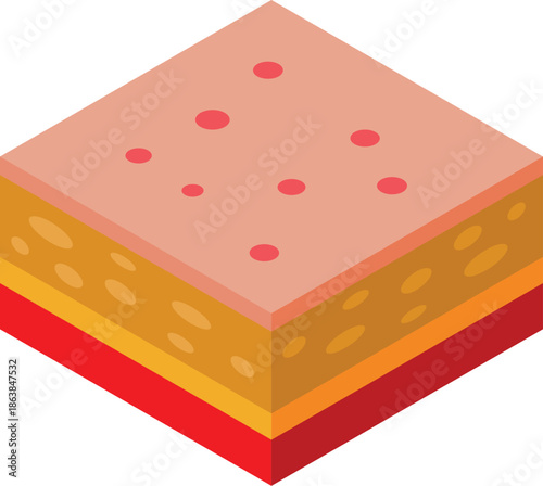 Isometric view of skin layers showing acne, epidermis, dermis, and hypodermis, useful for educational and medical purposes