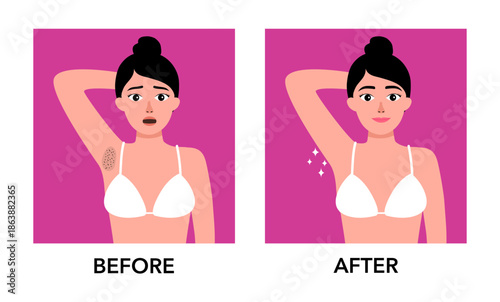 Young woman worrying about dark armpit hair problem comparing with smooth whitening clean armpit. Before and after laser hair removal concept.