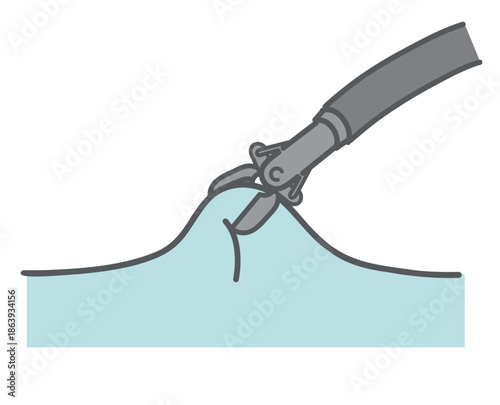 内視鏡による生検（組織採取）の瞬間のイラスト