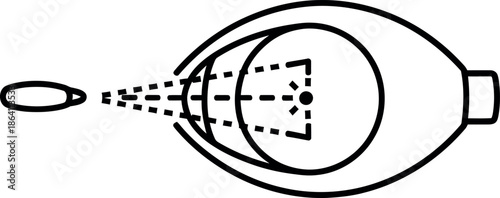 A black and white diagram illustrating the basic process of light focusing inside the human eye