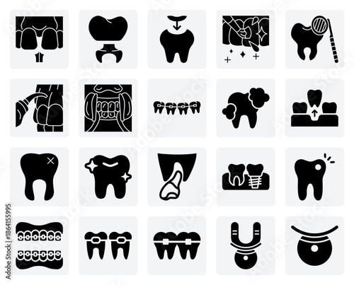 Repairing Damaged Teeth – Restorative Procedures For Cracked Teeth Including Crowns, Bonding, And Fillings For Long-Term Dental Health