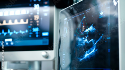 Canvas Print Medical ultrasound equipment displaying real-time imaging of a patients heart in