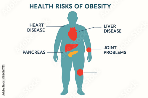 Health risks of obesity: key affected organs and problems highlighted
