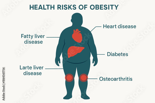 Health risks of obesity: heart disease, diabetes, osteoarthritis, liver disease