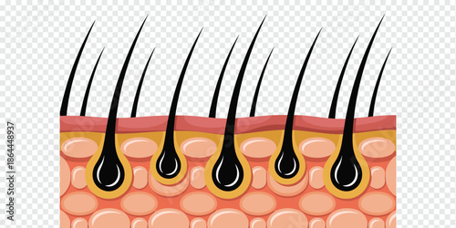 Anatomy of Human Skin with Hair Follicles dermatology concept