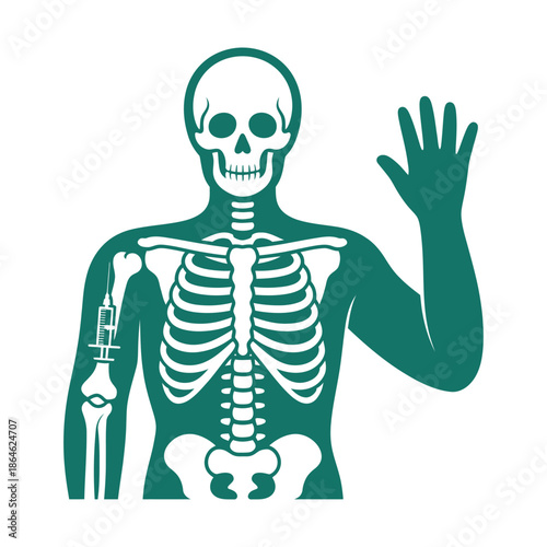 Human skeleton graphic shows shoulder joint replacement surgery occurring on.
