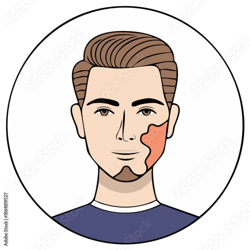 Man's Face with Port Wine Stain Birthmark in Round Circle Illustration