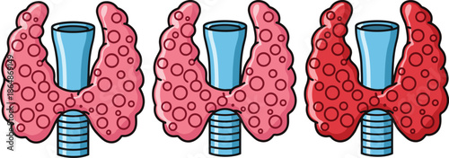 Set of Three Anatomical Thyroid Gland Illustrations in Red Tones Representing Endocrine System Health Medical Science Hormones Biology Education and Thyroid