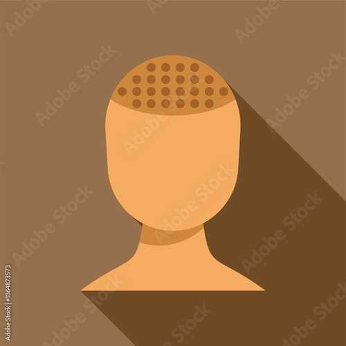 Human head with dots indicating new hair follicles implanted for hair restoration