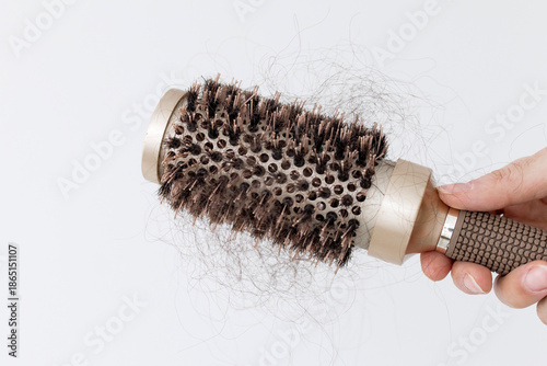Obraz na płótnie Close-up of round hairbrush with clumps of fallen hair, symbolizing hair loss caused by vitamin deficiency, low ferritin, protein shortage or hormonal imbalance