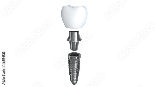 Dental implant components elegantly showcased with a floating arrangement on dark surface