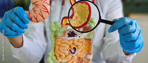 Fotografie Magnifying glass and colon diseases and colorectal cancer and ulcerative colitis