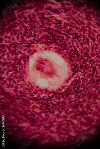 Tableau sur toile Microscopic view of a developing ovarian follicle with distinct granulosa cells and oocyte at the center, stained for histological analysis