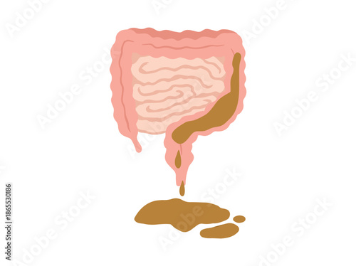 Diarrhea Disease Clip Art Illustration
