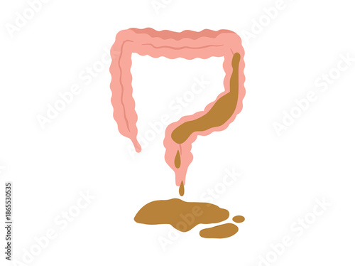 Diarrhea Disease Clip Art Illustration
