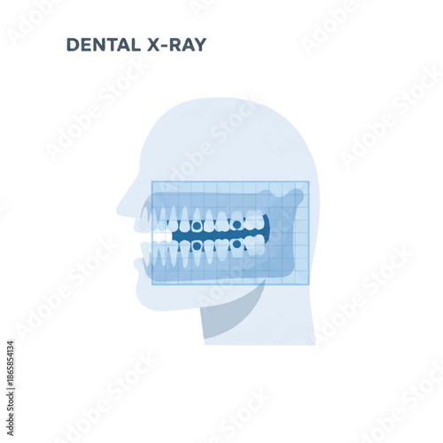 Dental X-ray and Orthodontic Concept. Medical Radiography of Human Jaw and Teeth Profile. Dentistry Diagnostic Health Illustration Vector on White Background.