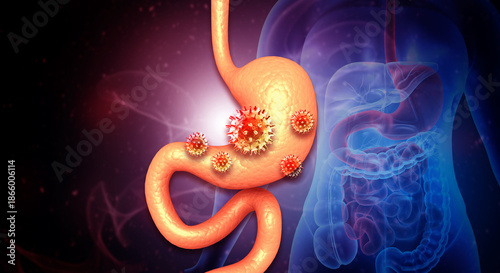 Photos 3D Illustration of Human Stomach with Virus Cells