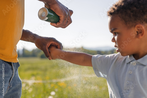 Принти на полотні Dad carefully applies insect and tick protection to his little son, spraying rep